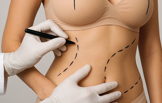 Laser Resurfacing